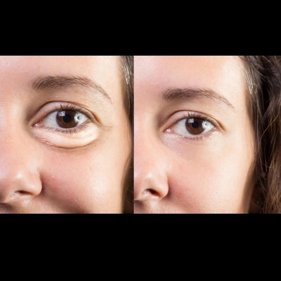 Mudmasky Vitamin Infused Eye Serum▪︎1 fl oz - Picture 3 of 8